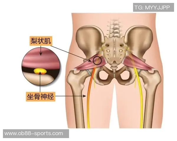 专家解读坐骨神经痛成因及治疗方法大多数患者可避免手术治疗 专家解读坐骨神经痛成因及治疗方法大多数患者可避免手术治疗