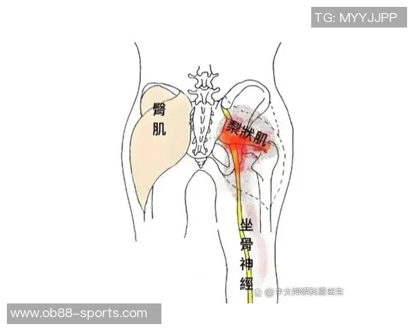 专家解读坐骨神经痛成因及治疗方法大多数患者可避免手术治疗 专家解读坐骨神经痛成因及治疗方法大多数患者可避免手术治疗